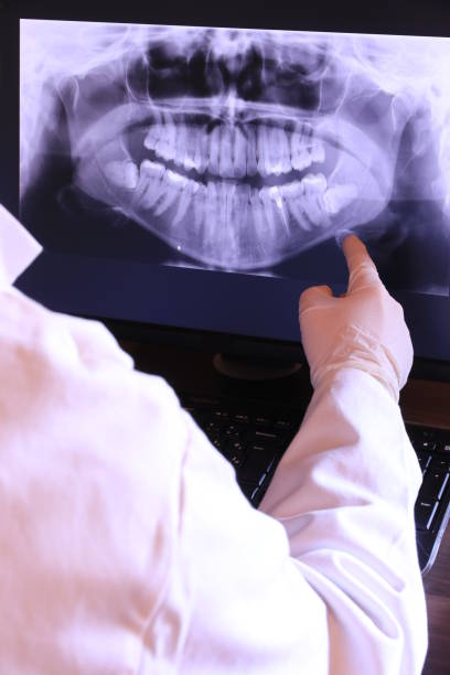 Best Emergency Denture Repair in Cedar Hill, MO
