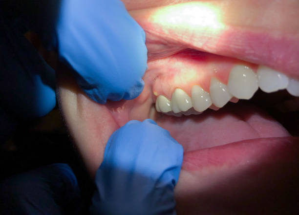 Trusted MO Emergency Dental Service Experts