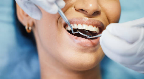 Best Dental Abscess Treatment in Cedar Hill, MO