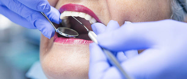 Best Broken or Chipped Tooth Repair in Cedar Hill, MO